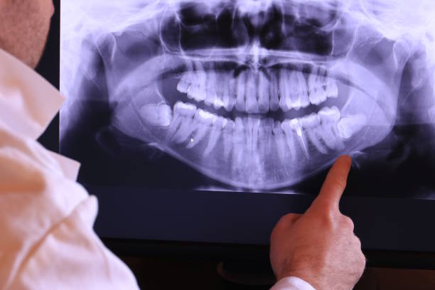 Best Tooth Infection Emergency Dentist  in Second Mesa, AZ