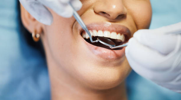 Best Chipped Tooth Repair Near Me  in Second Mesa, AZ